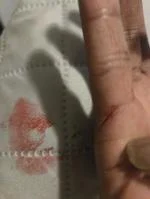 Injured while putting together 1
